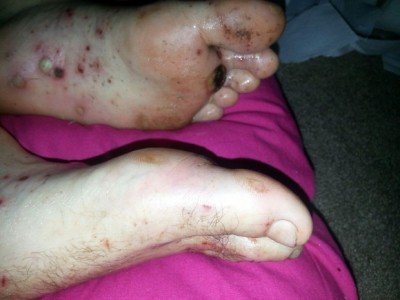 An alleged photo of Carl's feet.  (Photo: The Blaze)