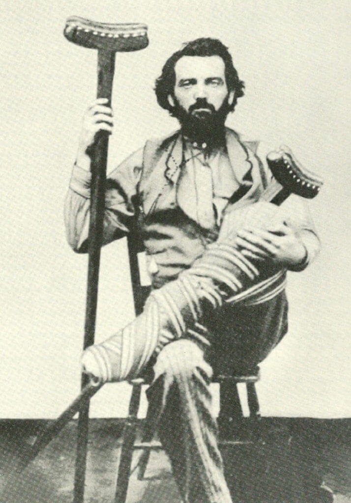 The Life and Times of the Brain-Damaged Gunslinger Clay Allison