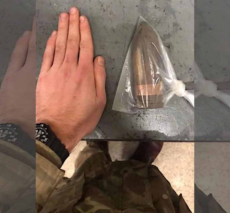 Bomb Squad Called to U.K. Hospital for Patient with Shell Stuck in Behind